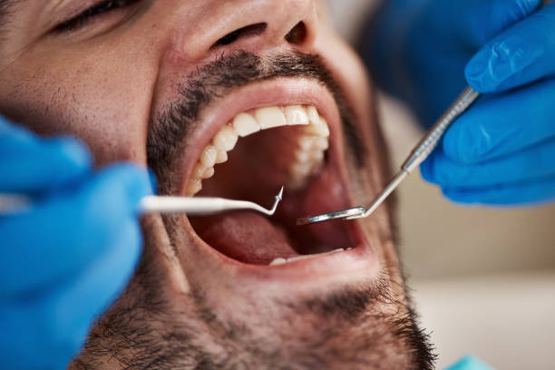 Dental X-Rays and Imaging in Tye, TX